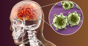 viem-mang-nao-o-nguoi-lon-do-dau-2