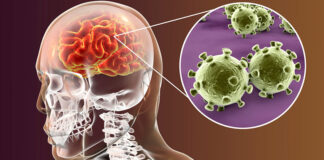 viem-mang-nao-o-nguoi-lon-do-dau-2