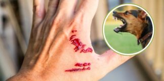 xu-tri-vet-thuong-dung-khi-bi-cho-meo-can-de-phong-benh-dai-1